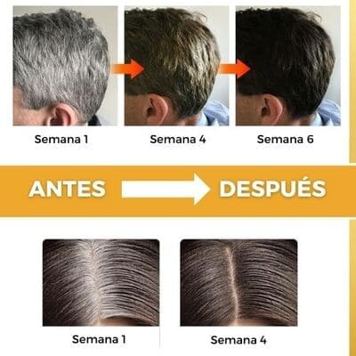 JABÓN ANTICANAS