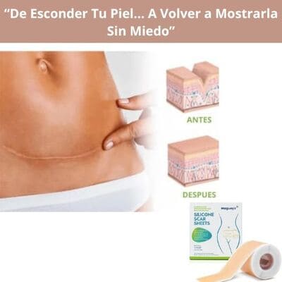 CINTA ELIMINACIÓN DE CICATRICES
