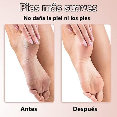 Lima Electrica para Pies Recargable USB