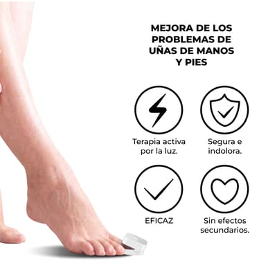 Laser De Hongos Para Uñas