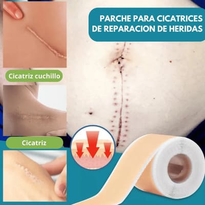 CINTA ELIMINACIÓN DE CICATRICES