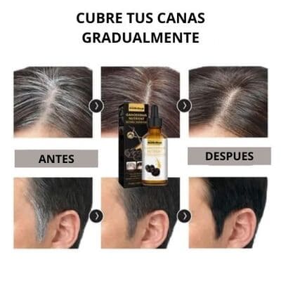 SERUM ANTICANAS