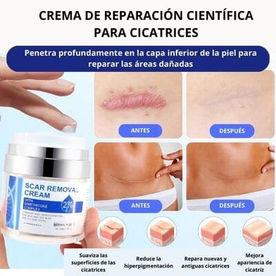 Crema Para Cicatrices