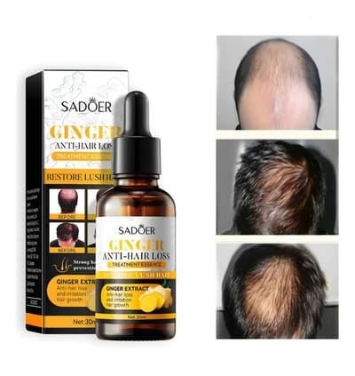 Serúm De Jengibre Para Cabello (Anticaída y Crecimiento)