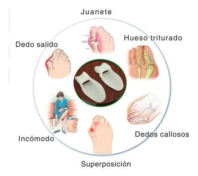 CORRECTOR DE JUANETE SILICONA
